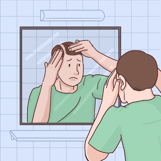 하루 50~100개의 모발이 빠지는 건 모발 성장주기에 따른 자연스런 현상이다. 하지만 ▲하루 100개 이상 모발이 빠지거나 ▲모발이 얇아지고 ▲이마선이 드러나며 ▲머리카락을 50~100개 정도 가볍게 당겼을 때 3개 이상 빠진다면 병원을 찾아 전문가에게 정확한 진단부터 받는 것이 좋다(사진=클립아트코리아).